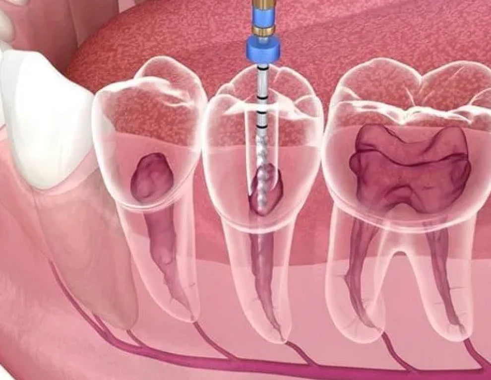 Dental Reconstruction
