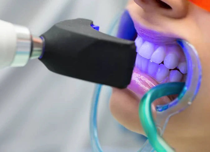 Teeth Whitening