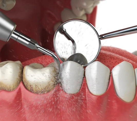 Dental Cleaning