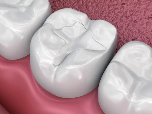Dental Filling